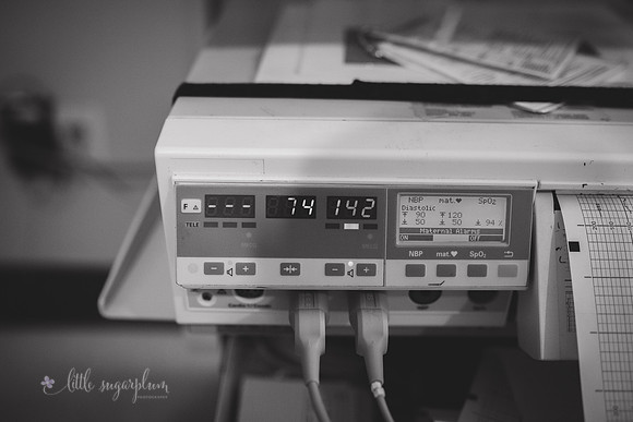 Jenn's Birth  (13) BW
